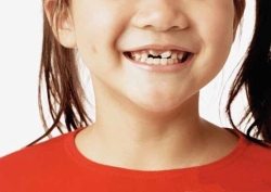 原创| 微微一笑齿倾城，孩子换牙期出现双层牙，家长千万别大意！