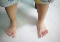 大暑天孩子要不要穿袜子：必须穿，不然寒气入内？赤脚可治百病？